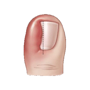 Cursor